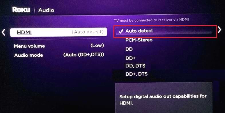 Select Auto Detect